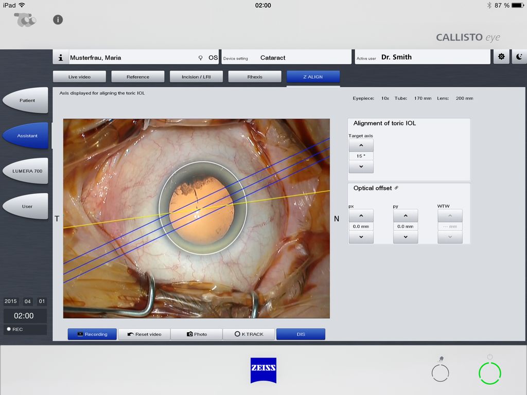 ZEISS Callistool App Screenshot 2