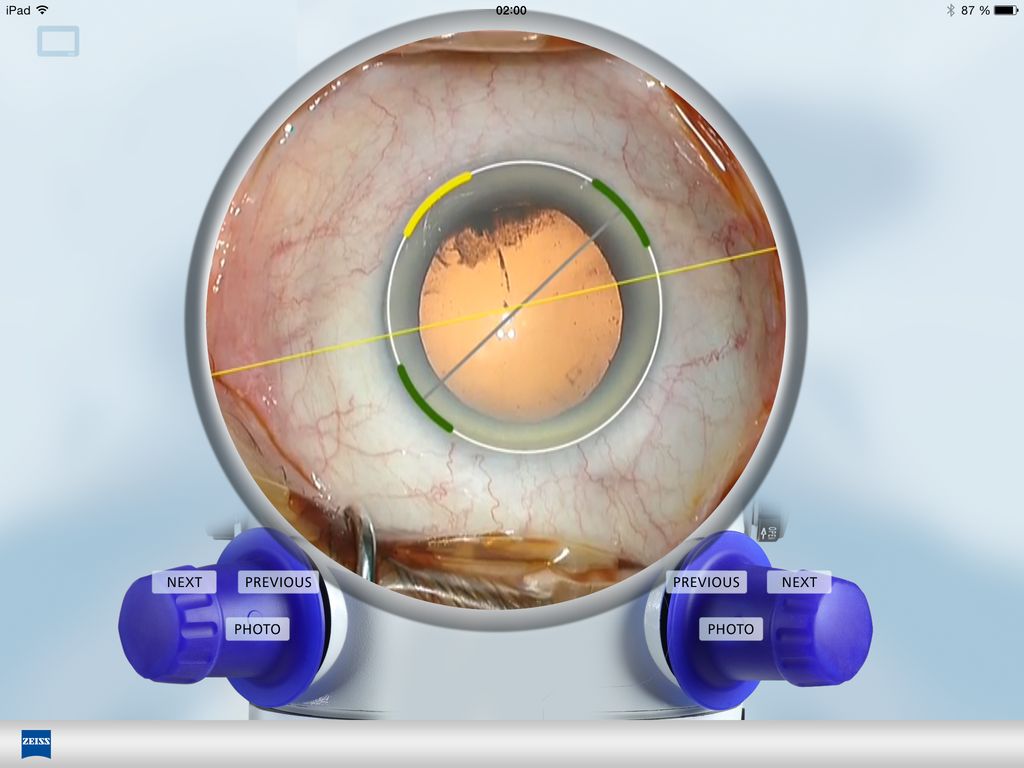 ZEISS Callistool App Screenshot 3