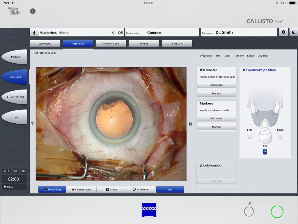 ZEISS Callistool App Screenshot 4